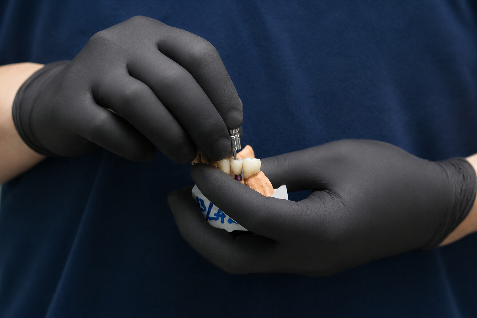 Helps prevent surrounding teeth from shifting into the missing space.